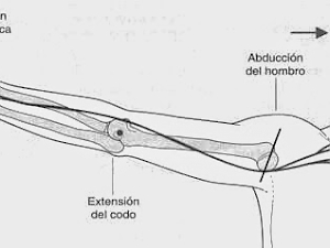 ¿Patrones espásticos o pérdida de rango a nivel neural?