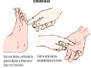 Intervención en el déficit de sensibilidad superficial