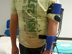 SaeboFlex: un nuevo dispositivo para la rehabilitación del brazo en pacientes con daño neurológico