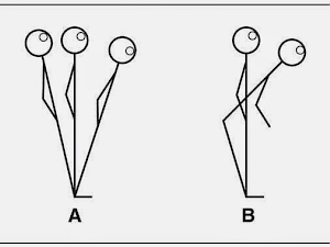 Evaluación del equilibrio y la estabilidad mediante posturografía (1ª parte)