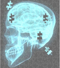 Neuroplasticidad en la rehabilitación del paciente neurológico